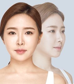 전/후 사진 배너의 모델 두 명(정면·옆)